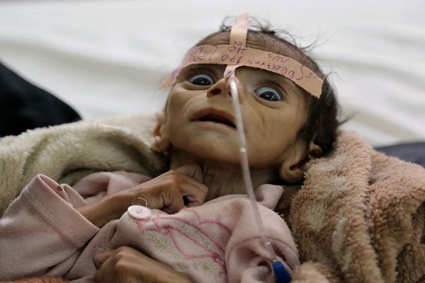 Over 10,000 Yemenis Die Due to Saudi Aerial Blockade