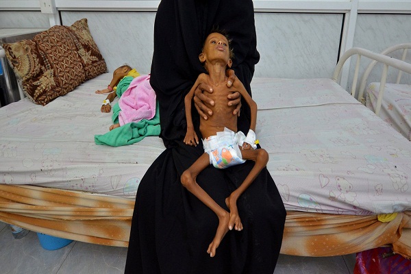 Causing Starvation, Saudi-Led Coalition’s Strategy in Yemen