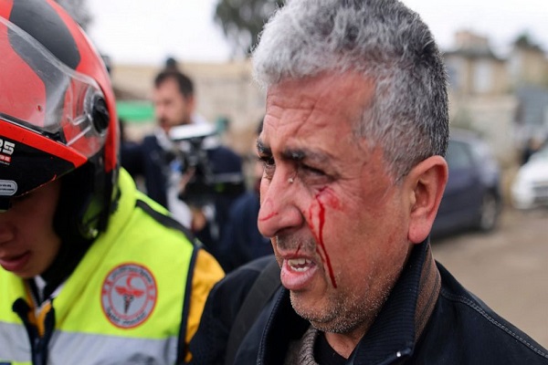 AP Outraged After Israeli Forces Beat Photographer in Al-Quds