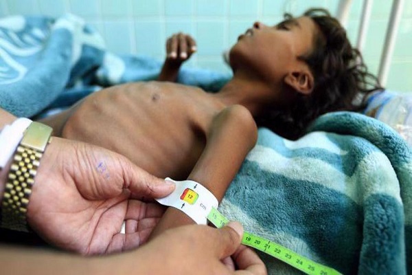 Dire humanitarian situation in Yemen 