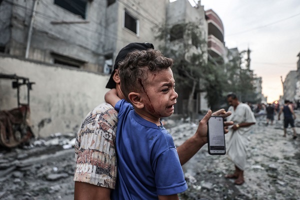 A child wounded in Israeli attacks on Gaza