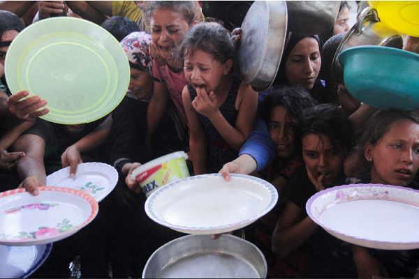 Gaza children suffering from malnutrition as a result of Israeli war and siege