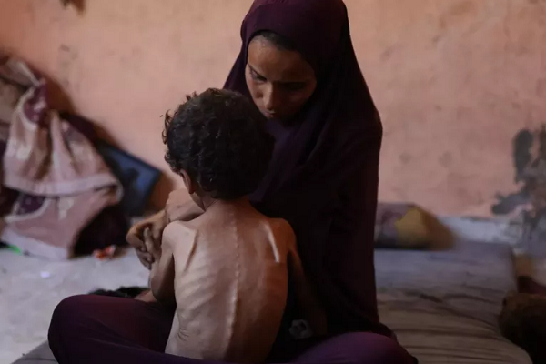 People in the Gaza Strip continue to suffer from malnutrition despite a ceasefire that came into foce in October 2025.