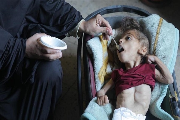 The UN agency for Palestinian refugees (UNRWA) says more than 66,000 children in Gaza are suffering from severe malnutrition.