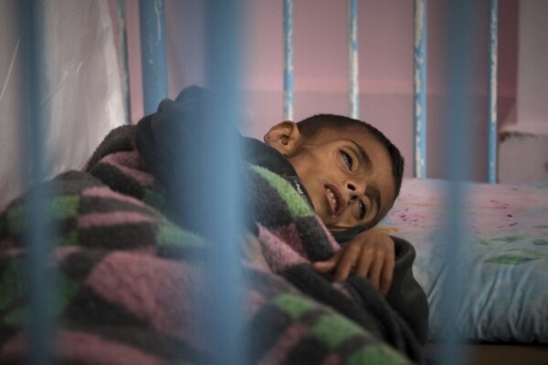 Scores of people, mainly children, have died of severe malnutrition caused by Israel’s crippling siege on the Gaza Strip.