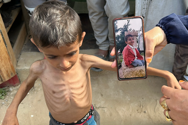 Children in Gaza struggle to survive amid Israeli bombs and aid blockade
