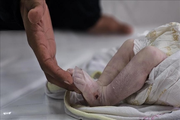 A Palestinian infant killed due to exposure to extreme cold in the Gaza Strip
