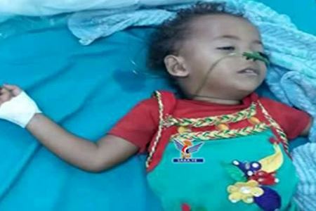 کودکان یمن و کابوسی هزار روزه