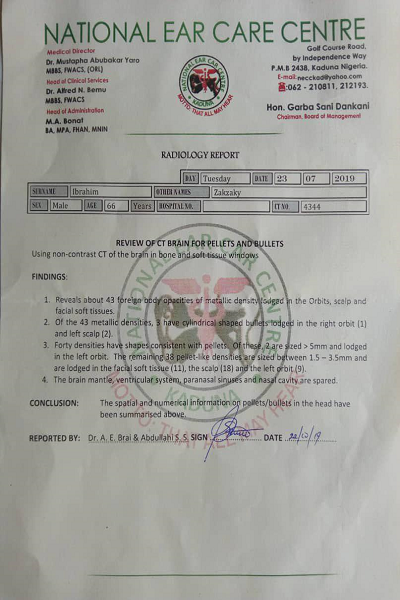 منابع بیمارستانی: ۴۳ ترکش در بدن شیخ زکزاکی وجود دارد