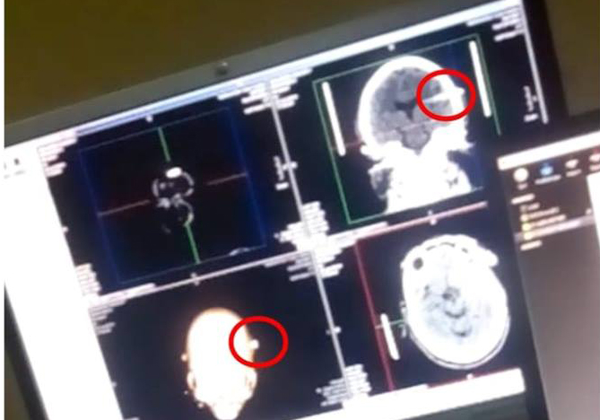 تصاویری از وضعیت وخیم شیخ زکزاکی 