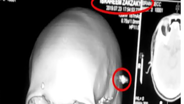 دختر شیخ زکزاکی: پزشکان مجاز به معاینه پدرم نیستند 