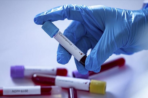 از درخواست بودجه 5 تریلیون دلاری تا هشدار با تابوت در خیابان‌های فیلیپین