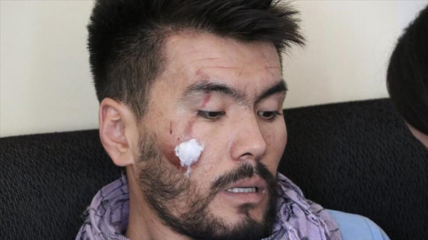 بیانیه طالبان درباره لیست سیاه آمریکا/ گزارش دیده‌بان حقوق‌بشر درباره شکنجه روزنامه‌نگاران افغان