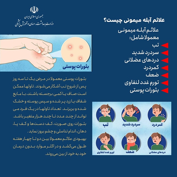 در حال تکمیل/ اینفوگرافیک | علائم آبله میمونی چیست