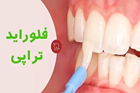 ۷۰ درصد دانش‌آموزان مقطع ابتدایی میرجاوه فلورایدتراپی شدند