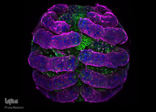 جنین عنکبوت در بزرگ‌نمایی ۲۰ برابر. پوست جنین با رنگ صورتی و اسکلت با رنگ آبی مشخص شده است. میکروتوبول‌ها هم سبز رنگ هستند