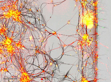 نورون‌های انسانی در یک بیمار پارکینسون با بزرگ‌نمایی ۴۰ برابر
