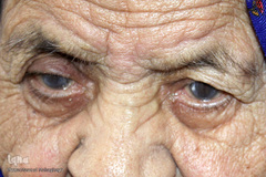 حکایت چشمان مادر...