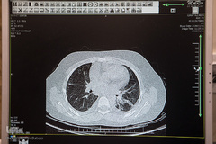سینه کوچک کودکان شهر که مخزن احساس و خاطره و لطافت است، میهمان ناخوانده‌ای دارد که باید به زور او را بیرون کرد.
