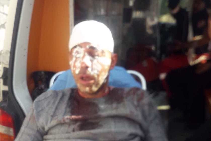 Un Palestinien blessé lors d'une attaque de colons près de Naplouse